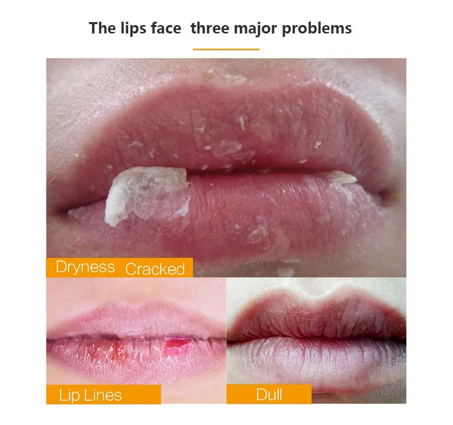 5pcs Collagen Crystal Gold Gel Lip Mask Anti-Aging Anti-wrinkle Moisturizer Lip Plumper
