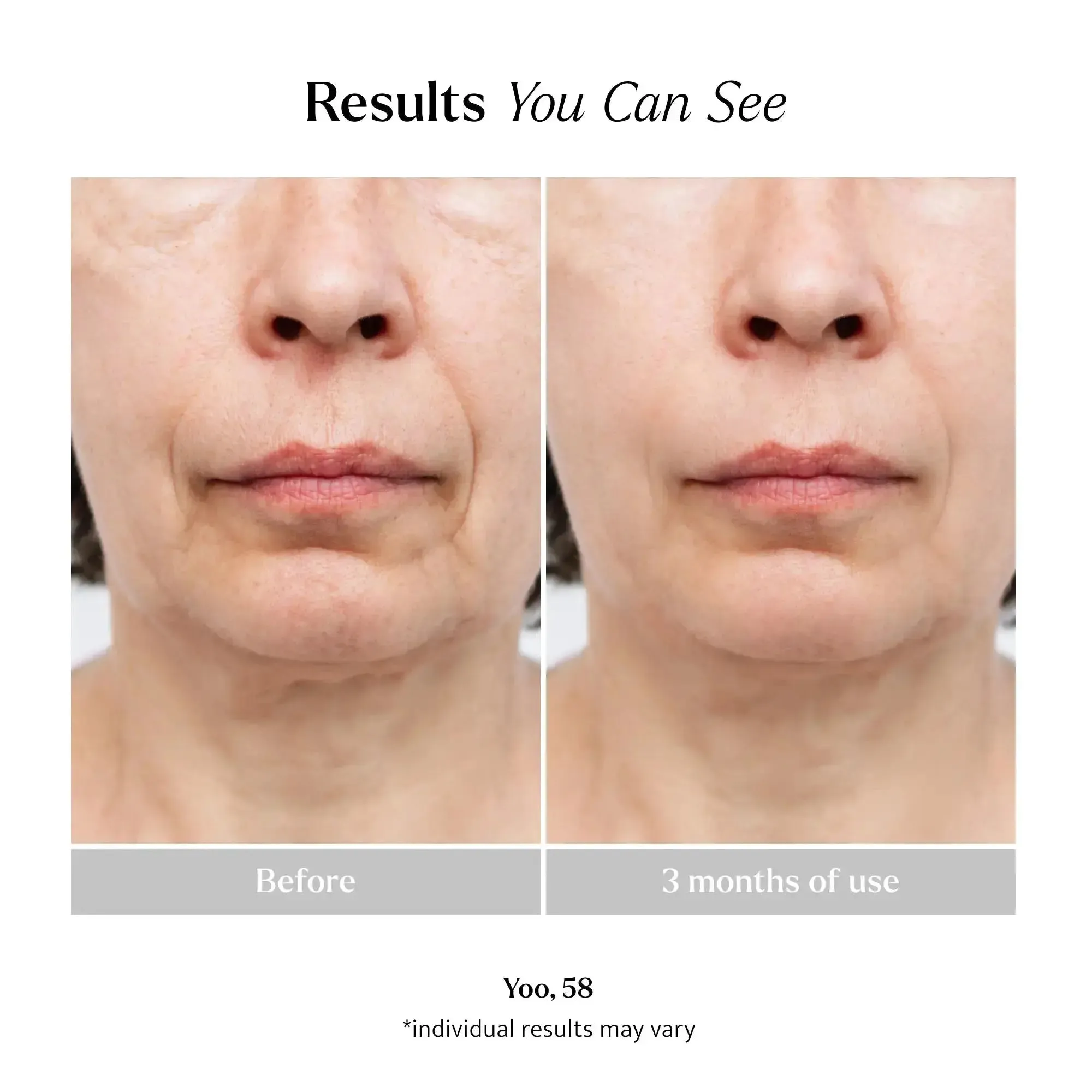 Ageless Serum