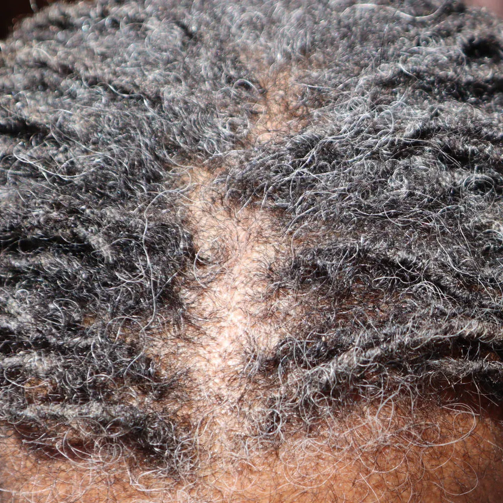 Roller Braid - Hair Growth Serum