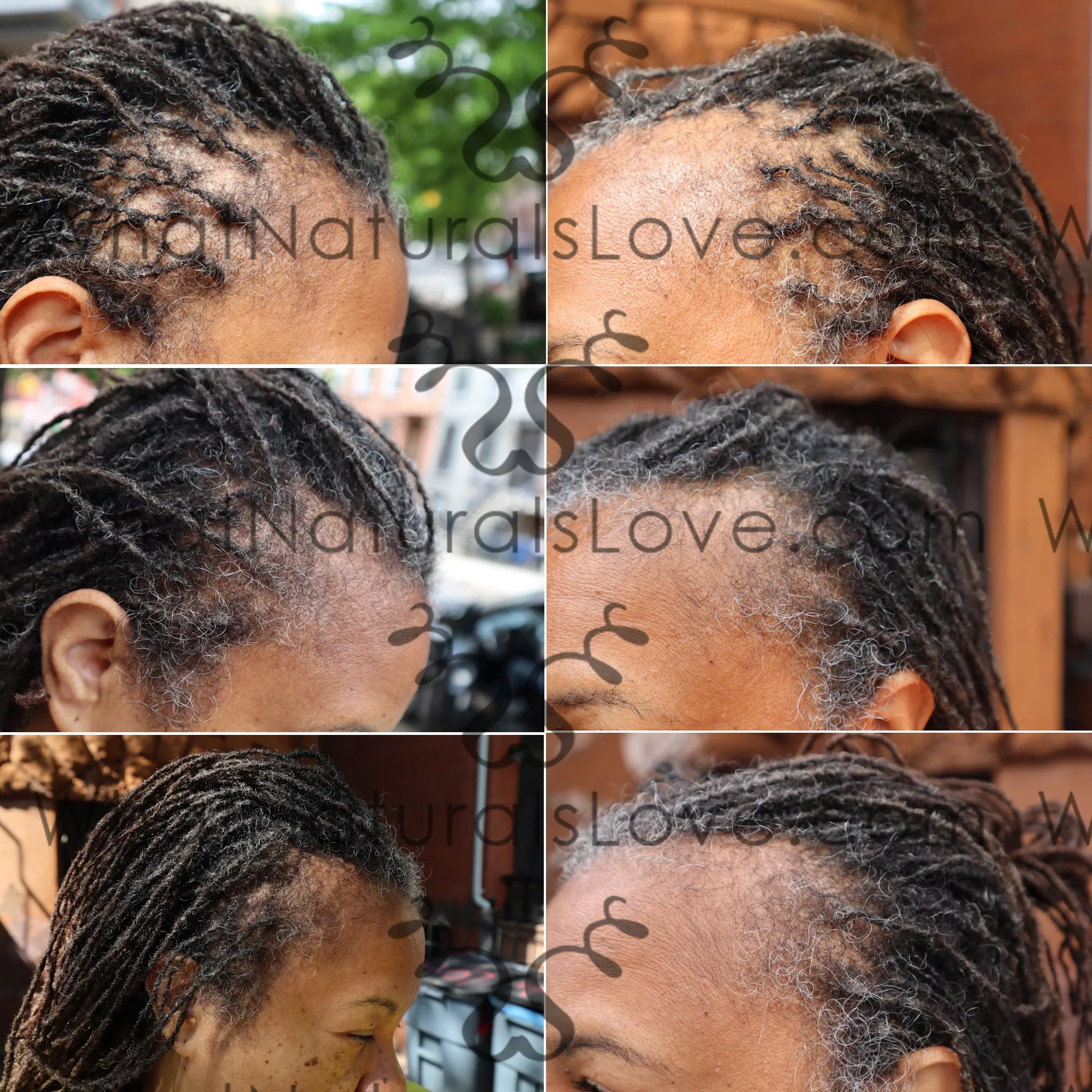 Roller Braid - Hair Growth Serum