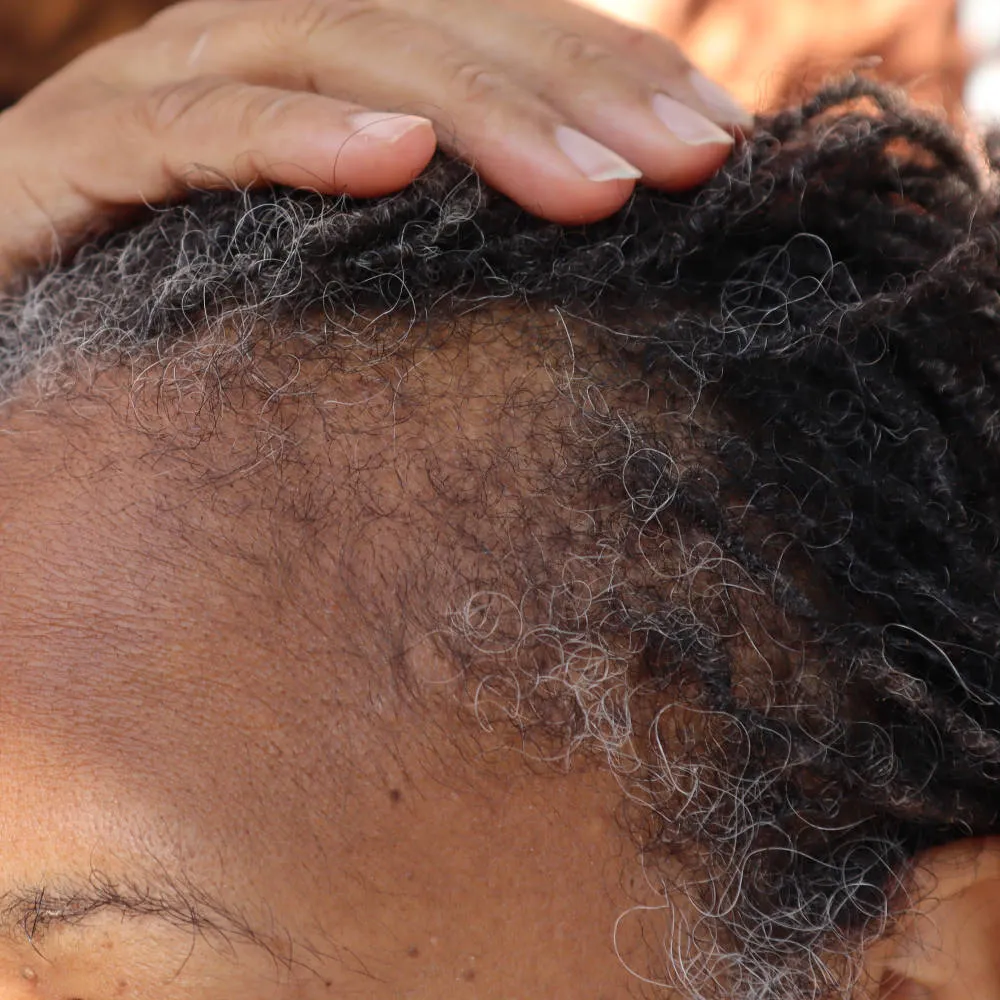 Roller Braid - Hair Growth Serum