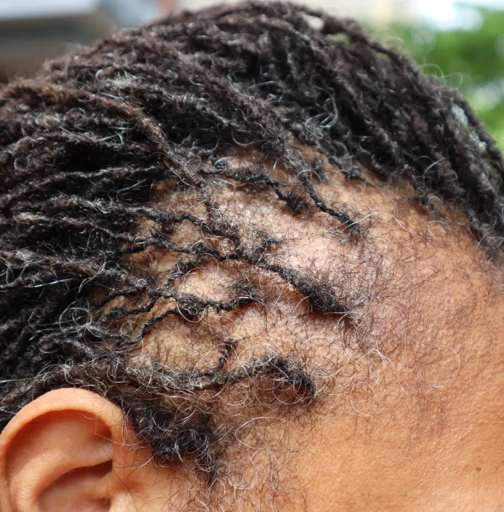 Roller Braid - Hair Growth Serum