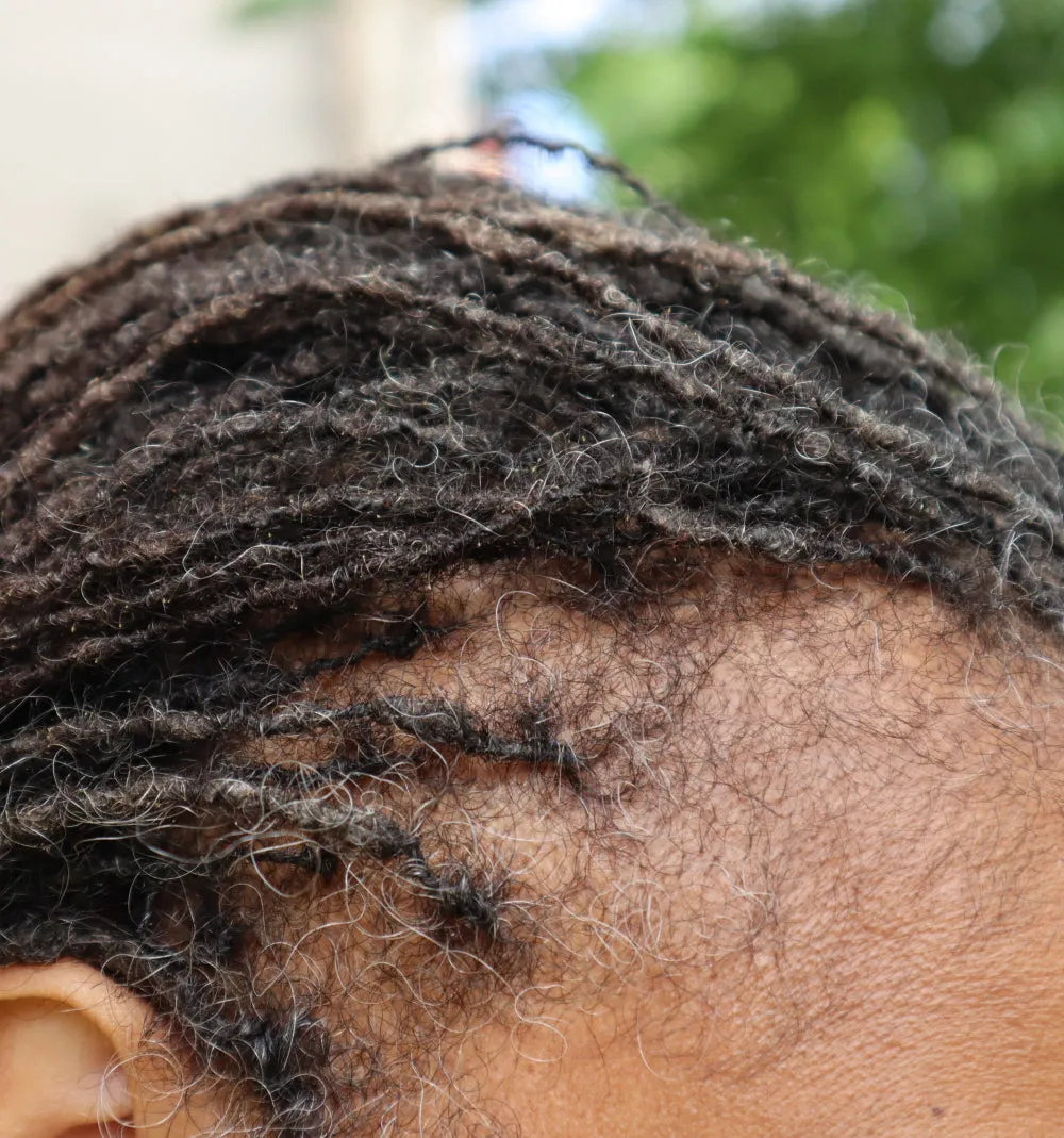 Roller Braid - Hair Growth Serum