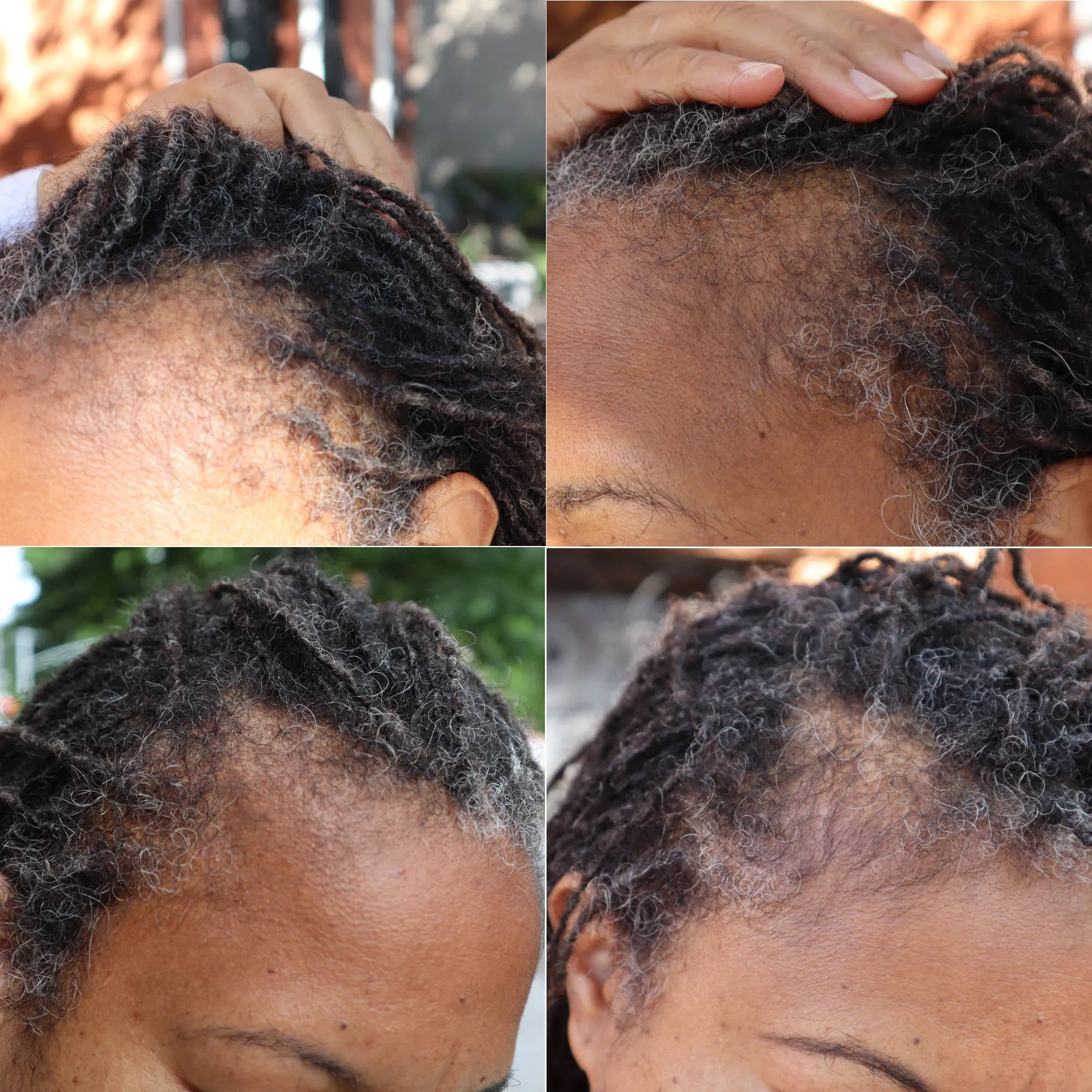 Roller Braid - Hair Growth Serum